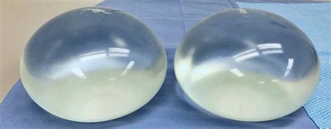 3000cc breast implant